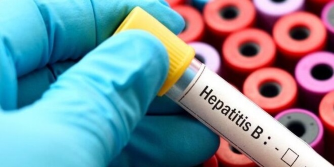 akut-hepatit-b-belirtileri-nelerdir