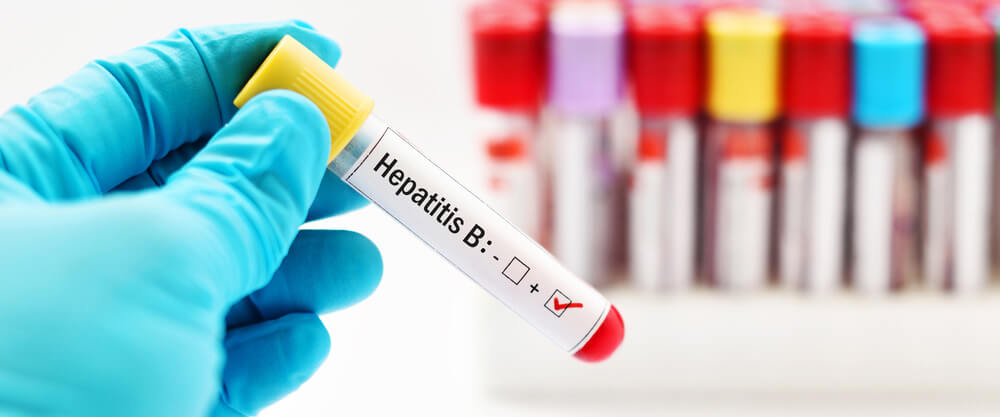 kronik-hepatit-b-belirtileri-nelerdir