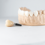 diş implantı diş implantı tedavisi