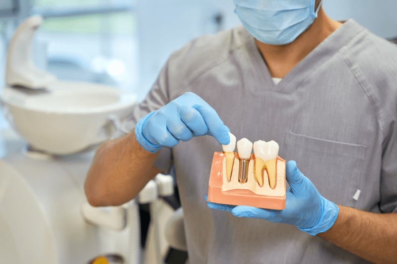 Diş Tedavileri